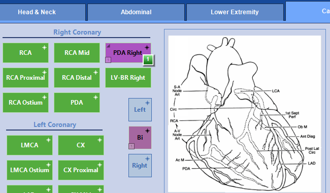 Cardiac