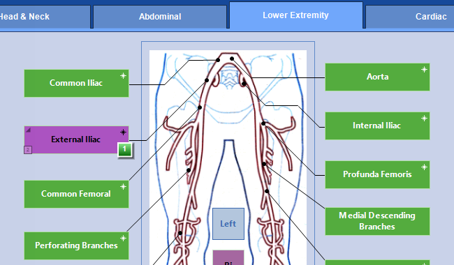 Lower Extremity